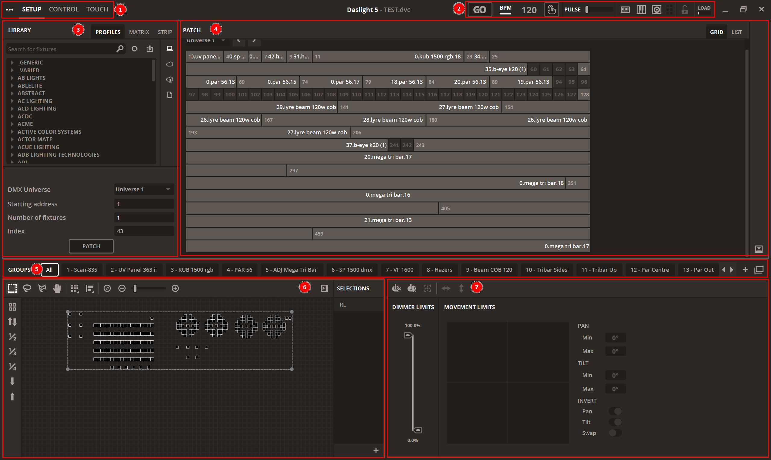 Interface de l'onglet Setup